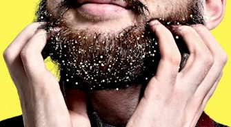 Beard_Dandruff