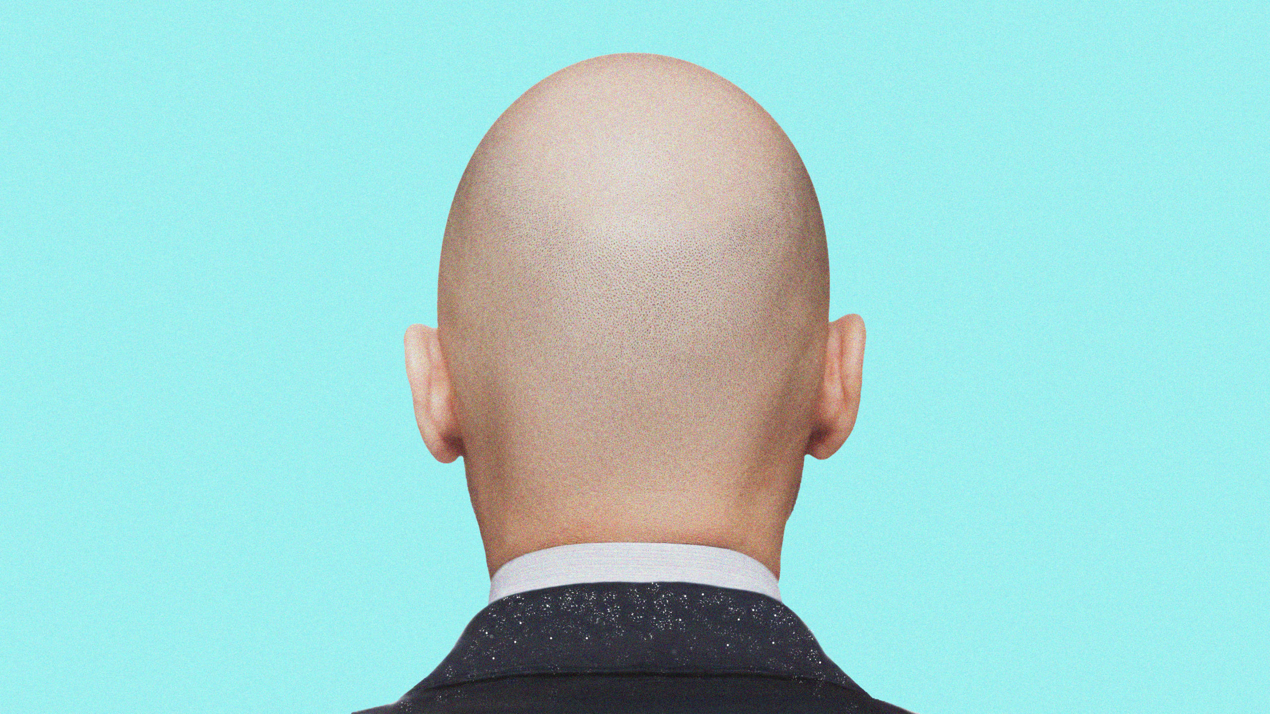 Can I Still Get Dandruff If I'm Bald? - Dollar Shave Club Original Content